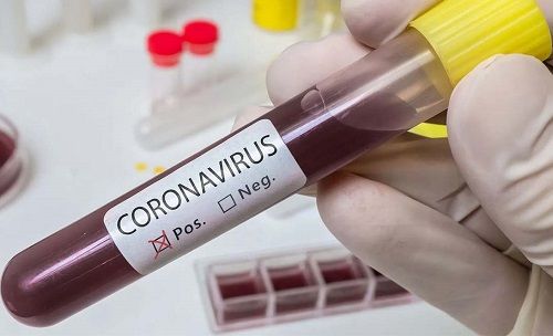 Coronavirus-positivo